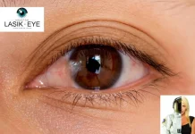 Costo de la cirugía de carnosidad: guía completa para mejorar tu salud ocular