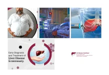 Top Best Liver Doctor in Ahmedabad for Expert Hepatology and Liver Disease Care