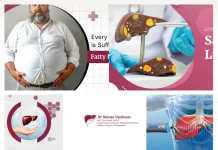 Expert Liver Cirrhosis Specialist Ahmedabad for Advanced Diagnosis and Treatment